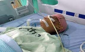 Remaja di Belawan Tewas Diduga Tertembak Polisi