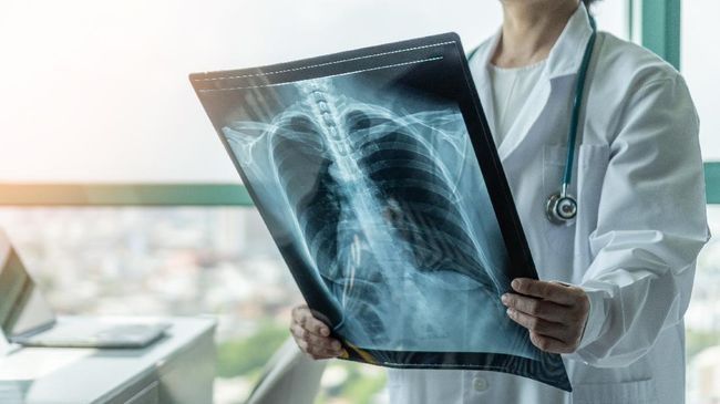 Gara-gara Vape, Paru-paru Pria Malaysia Terpaksa Jadi Kecil Sebelah
