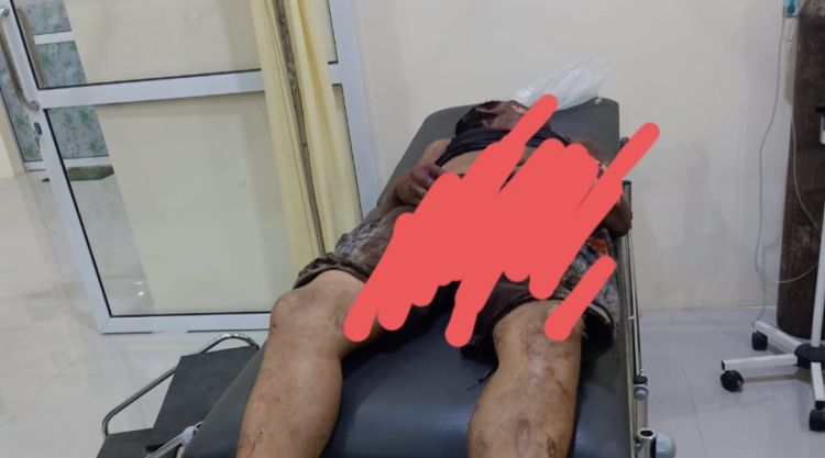 Ngertiken Sembiring Dibakar Warga Hingga Tewas