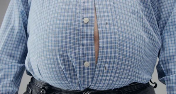 Lebih dari 4 Miliar Populasi Dunia Diprediksi akan Alami Obesitas