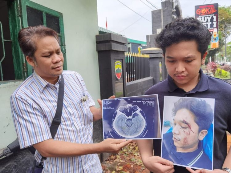 Polisi Selidiki Kasus Penganiayaan Diduga Dilakukan Taruna Akmil