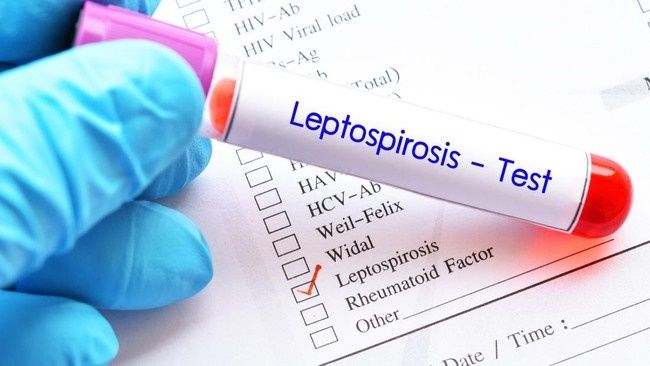 Leptospirosis Mewabah di Jatim, 133 Positif, 6 Pasien Meninggal