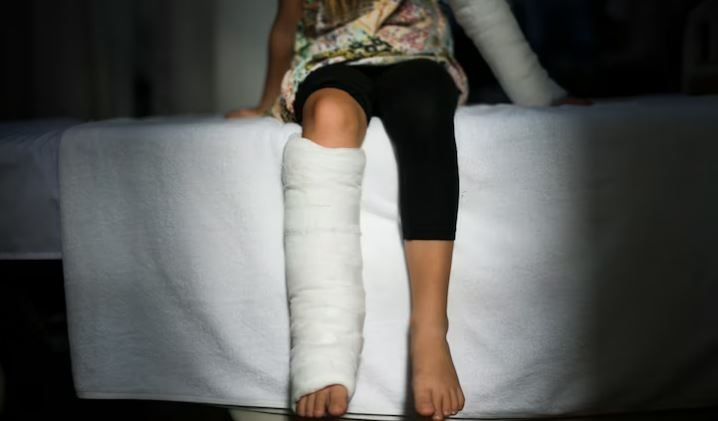 Benarkan Patah Tulang Bisa Sembuh Sendiri?