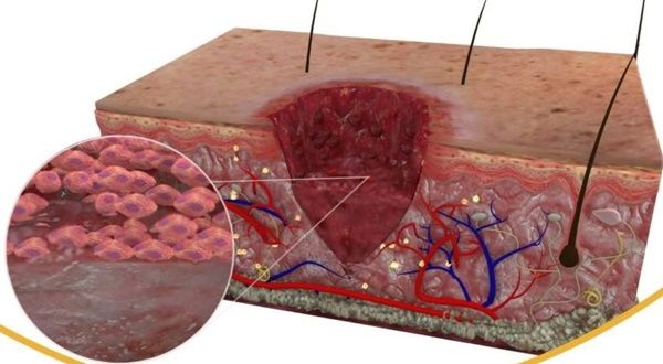 Ini Bagian Tubuh yang Berperan dalam Penyembuhan Luka