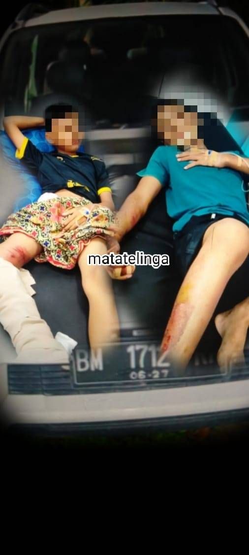 Kendarai Sepeda Ngebut di Jalan, Brak! Hantam Mobil, Dua Remaja Asahan Patah-Patah