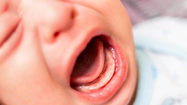 Studi Temukan Otak Bayi Rusak karena Covid-19