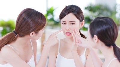 Cara Menghilangkan Jerawat Secara Alami, Mudah dan Murah