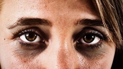 Cara Alami Mengatasi Mata Panda