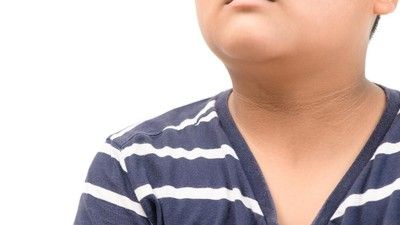 Bukan Cuma Daki, 6 Hal Ini Bisa Bikin Kulit Leher Jadi Hitam