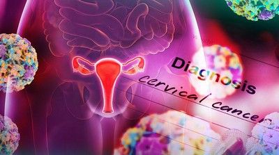 Penyakit Kutil Kelamin Bisa Jadi Kanker Serviks