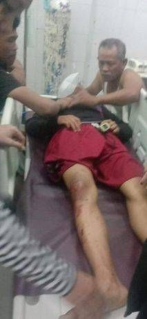 Terjadi di Wilkum Polres Belawan, Dua Mahasiswa Dibegal, Satu Korban Tewas