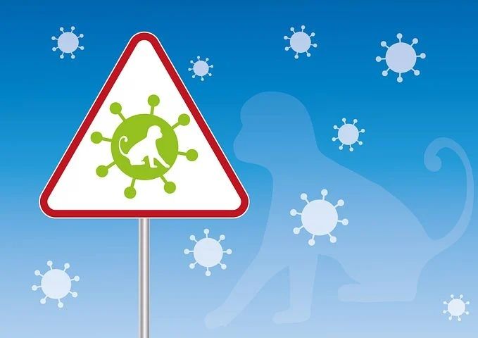 Dinkes Sumut Surati Daerah Untuk Antisipasi Dini Cacar Monyet