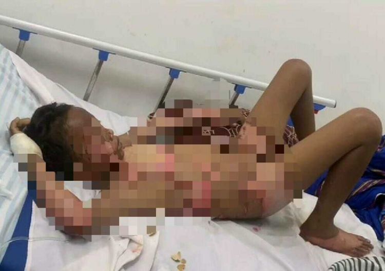 Kejadian Tragis di Belawan! Seorang Bocah Dibakar Karena Curi Ikan