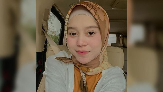 Polisi Sebut Tulang Leher Lesti Kejora Bergeser Akibat KDRT Rizky Billar