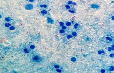 Deretan Virus Tertua di Dunia, Usianya Ada yang Ratusan Juta Tahun